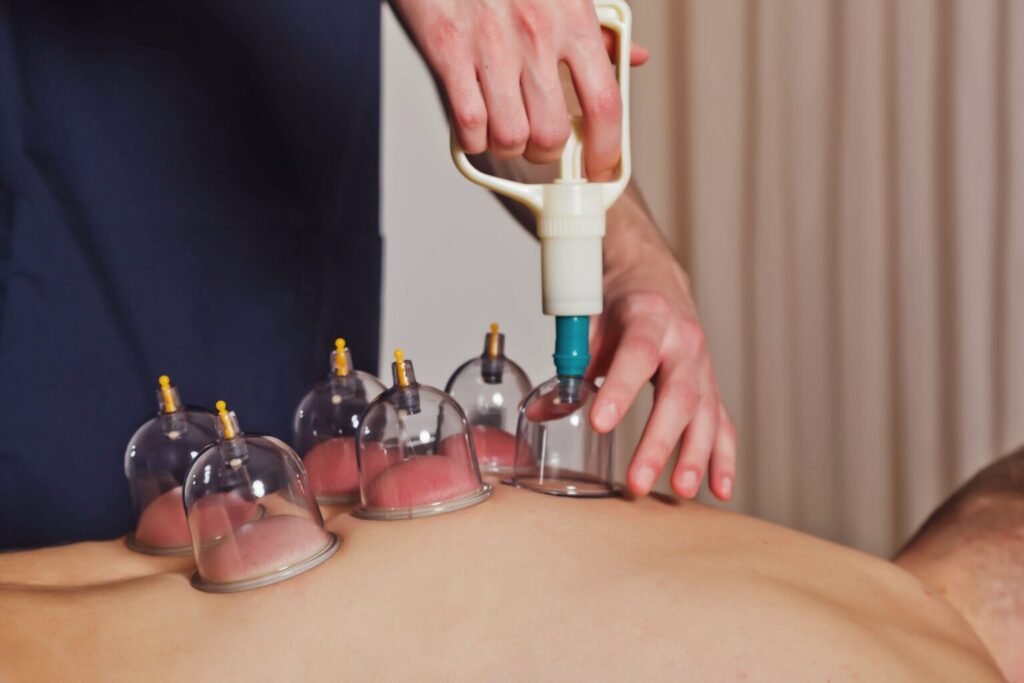 cupping therapy benefits for natural healing and pain relief