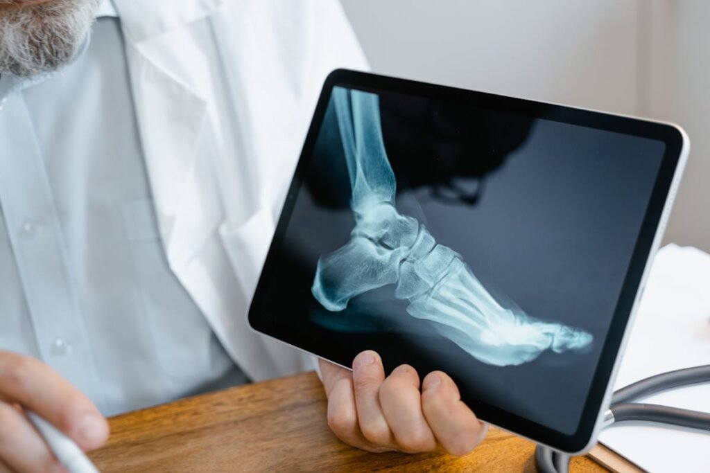 ankle sprain vs break